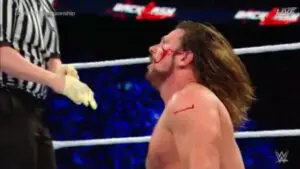 Watch AJ Styles Sustain Gruesome Injury During Backlash