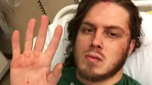 Joey Janela Provides Surgery Update — The Meds Make Him Feel Funny
