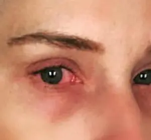 Michelle McCool Suffering From Nasty Issue Right Before Christmas