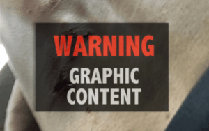 Kyle O’Reilly Shows Off Hole In His Back After NXT TakeOver: XXV Ladder Match