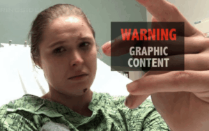 Ronda Rousey Tells All About Nearly Losing Her Finger In Freak Accident