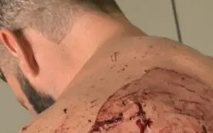 NASTY Photos Of Matt Cardona's Wounds After GCW Homecoming