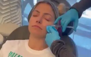 Alexa Bliss Shows Off Her 'Red Face' After Microneedling Procedure