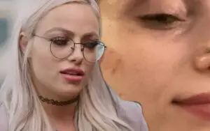 Liv Morgan Shows Off Nasty Bruises After Vicious Shayna Baszler Attack