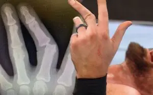 Dijak Shows X-Ray Of Brutal Dislocated Finger From WWE NXT Vengeance Day
