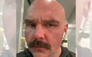 Dax Harwood Jokes About Getting Busted Open During AEW Revolution Return