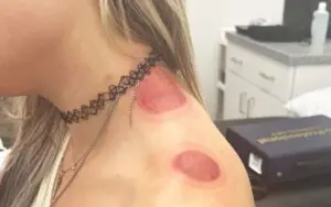 Liv Morgan Shows Off Brutal Surgery Rehabilitation Ahead of WWE King and Queen of The Ring