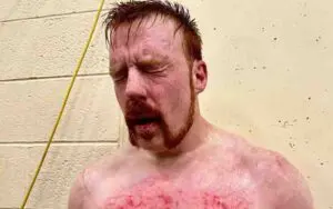 Sheamus Rules Out Part 4 Match After Showing Battle Scars from 5/6 WWE RAW Sheamus Rules Out Part 4 Match After Showing Battle Scars from 5/6 WWE RAW