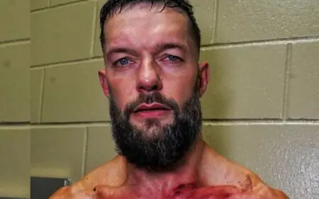 Finn Balor Shows Off Brutal Aftermath of GUNTHER's Offense After 7/29 WWE RAW