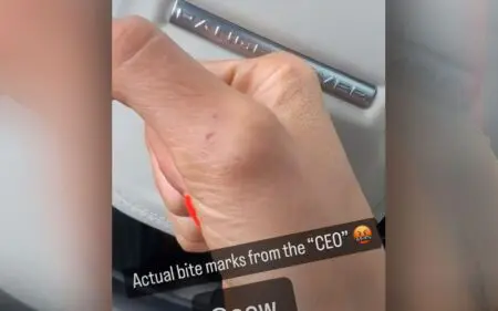 Britt Baker Shows Off Bite Marks Left By Mercedes Mone After Intense Match at AEW All-In