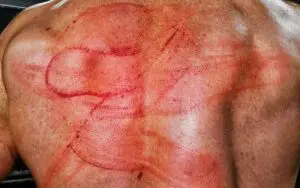 Drew McIntyre Shows Off Nasty Welts After CM Punk Assault on 8/12 WWE RAW