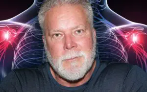 Kevin Nash Details Gruesome Bicep Tear and Upcoming Surgery