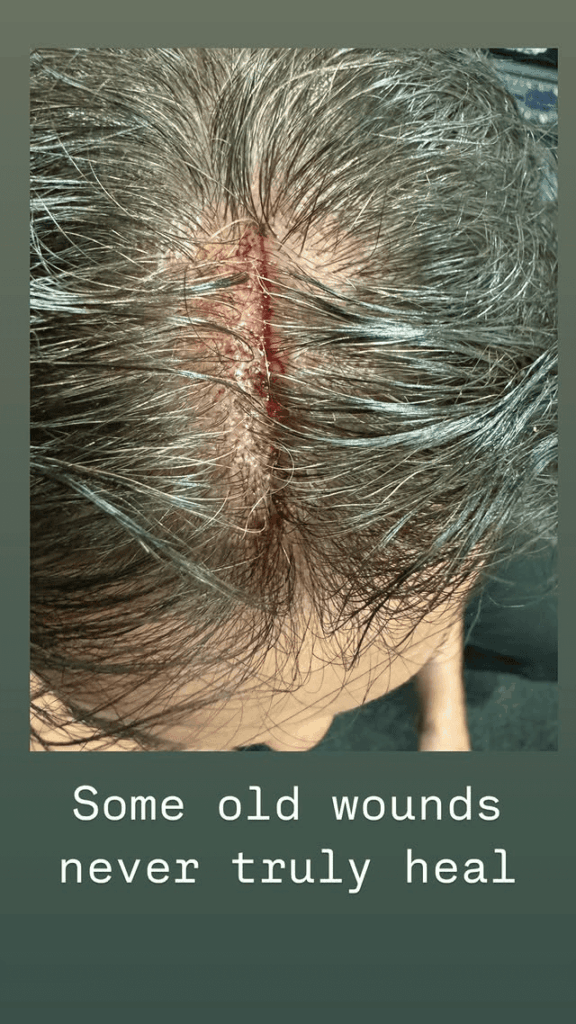 Drew McIntyre Suffers Nasty Head Injury on SmackDown