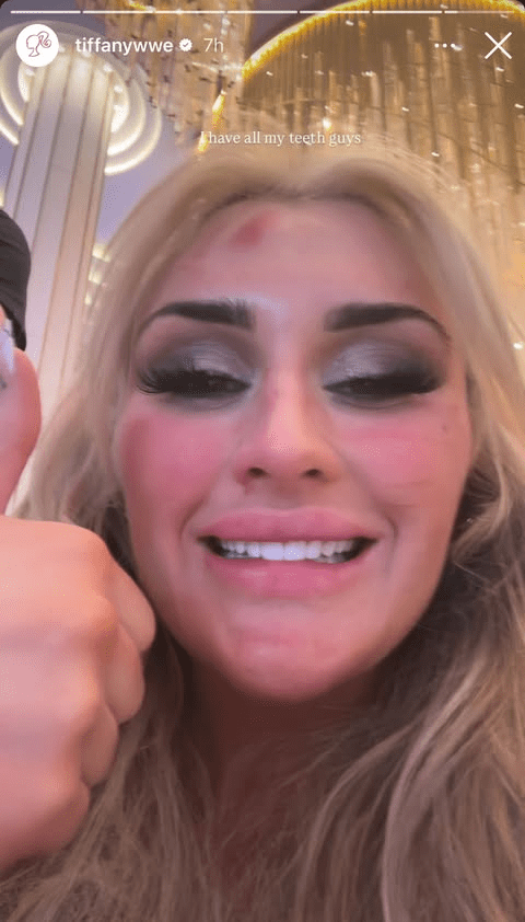 Tiffany Stratton Confirms She Didn’t Lose Any Teeth at WrestleMania