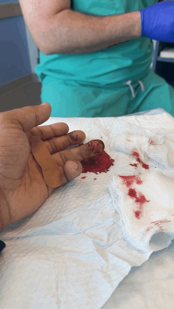 WWE NXT Star Shows Off Bloody Finger Injury After 4/29 Event