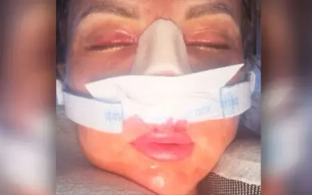 Harley Cameron Shows Brutal Post-Surgery Photo