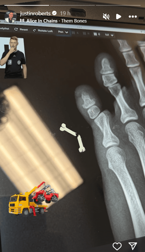 AEW Name Reveals Sustained Injury With Graphic X-Ray
