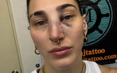 Rhea Ripley Shows Off Broken Nose After Brutal WWE Match in Japan