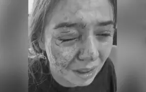 Eddie Guerrero’s Daughter Kaylie Suffered Gruesome Injury After Brutal Dog Attack Eddie Guerrero’s Daughter Kaylie Suffered Gruesome Injury After Brutal Dog Attack