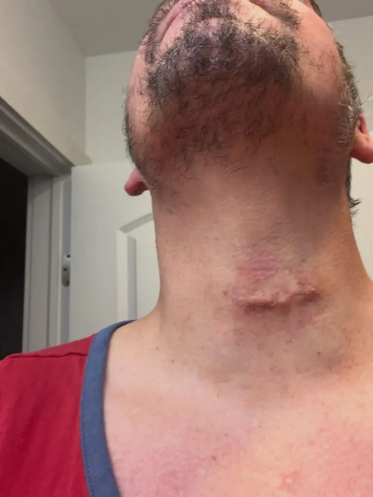 Chuck Taylor Undergoes Neck Surgery After Lengthy AEW Absence
