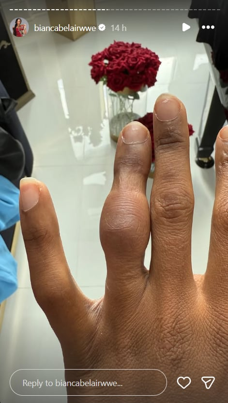 Positive Update on Bianca Belair's Recovery After Brutal WrestleMania Injury