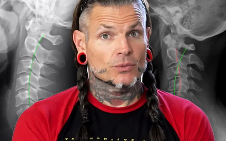 Positive Update on Jeff Hardy’s Recovery Amid Neck Struggles