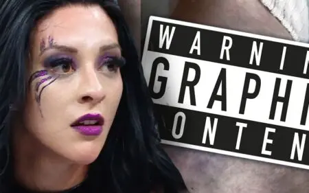 Stephanie Vaquer Shows Off Nasty Ankle Injury After WWE RAW Attack