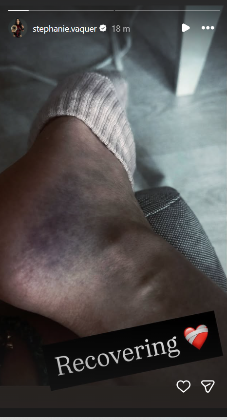 Stephanie Vaquer Shows Off Nasty Ankle Injury After WWE RAW Attack