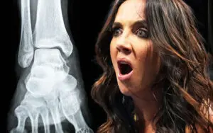 Chelsea Green’s Ankle Injury Far More Serious Than Expected