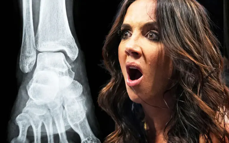 Chelsea Green’s Ankle Injury Far More Serious Than Expected