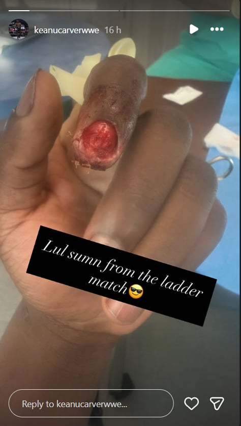 Keanu Carver Shows Off Nasty Injury From Brutal NXT Ladder Match
