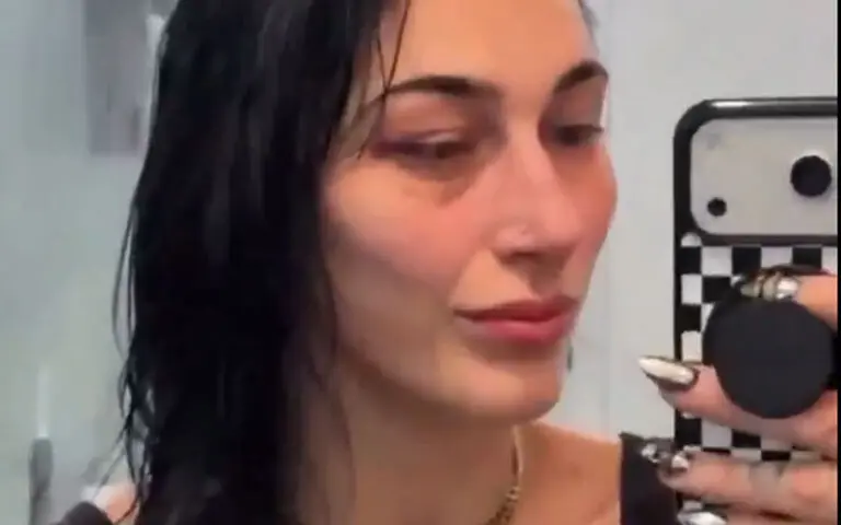 Rhea Ripley Shows Off Brutal Black Eye After SmackDown Win Over Giulia