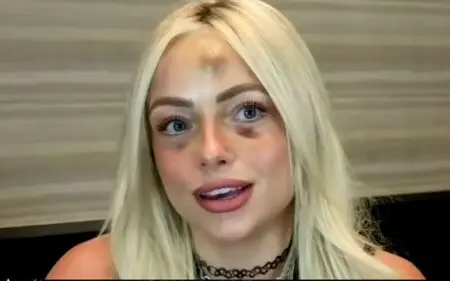 Liv Morgan Reveals Health Status After WWE RAW Injury Scare