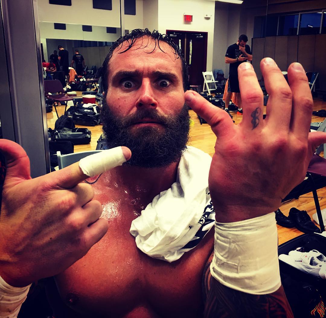 NXT Superstar Chad Lail Shows Off Gruesome Pinky Injury