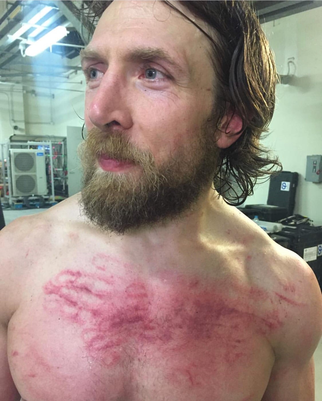 Daniel Bryan Reveals Who’s To Blame For His Blistered Chest During Greatest Royal Rumble