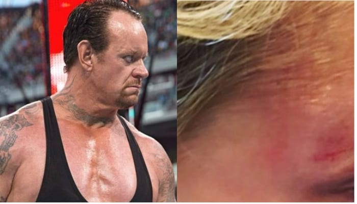 The Undertaker’s Daughter Suffers Easter Egg Hunting Related Injury