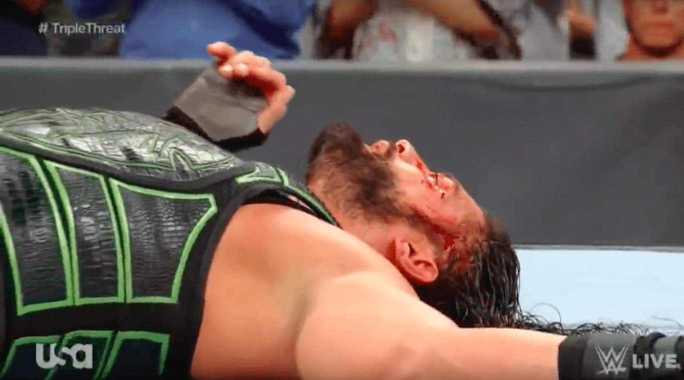 Did Roman Reigns Get Injured on RAW?