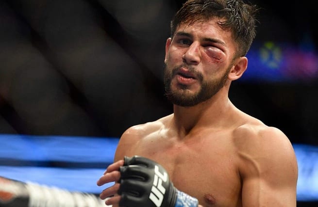Yair Rodriguez Is Out Of UFC 228