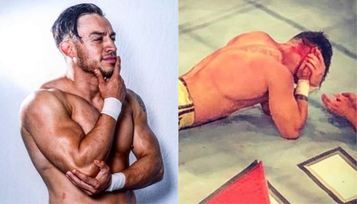 Update On Daga After Low Ki “Ripped His Ear Off”