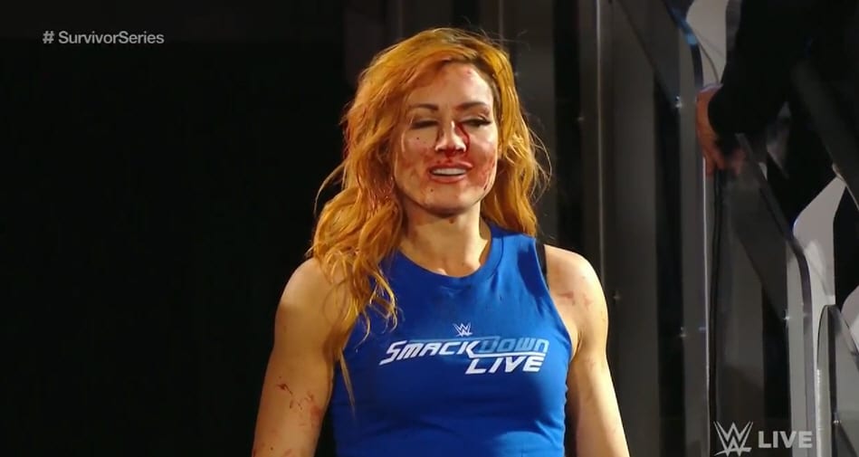Becky Lynch Busted Open On WWE Raw Before Survivor Series
