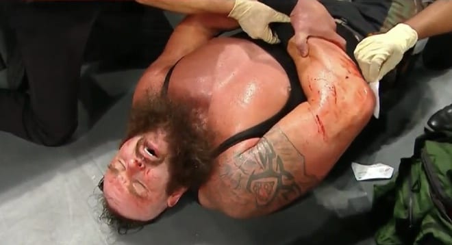 WWE Reveals The Nature Of Braun Strowman’s Injury On Raw