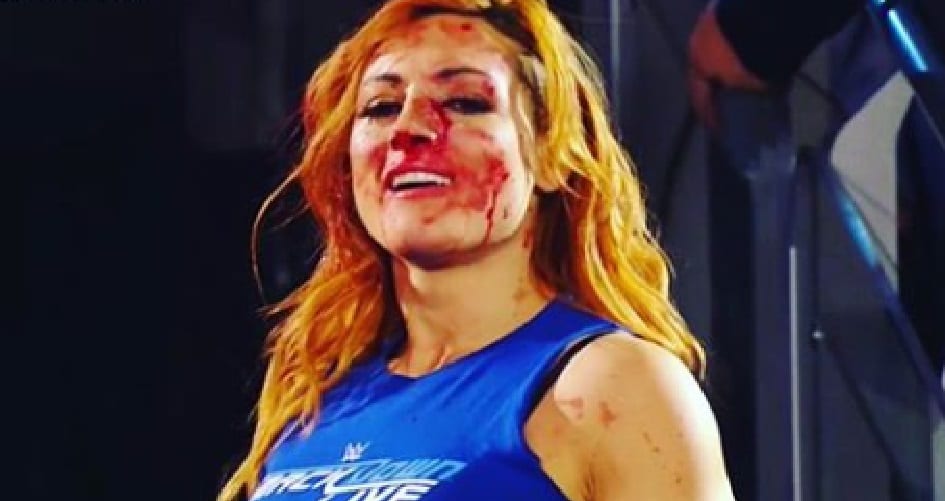 Why WWE Didn’t Disclose Becky Lynch’s Actual Injuries On SmackDown Live