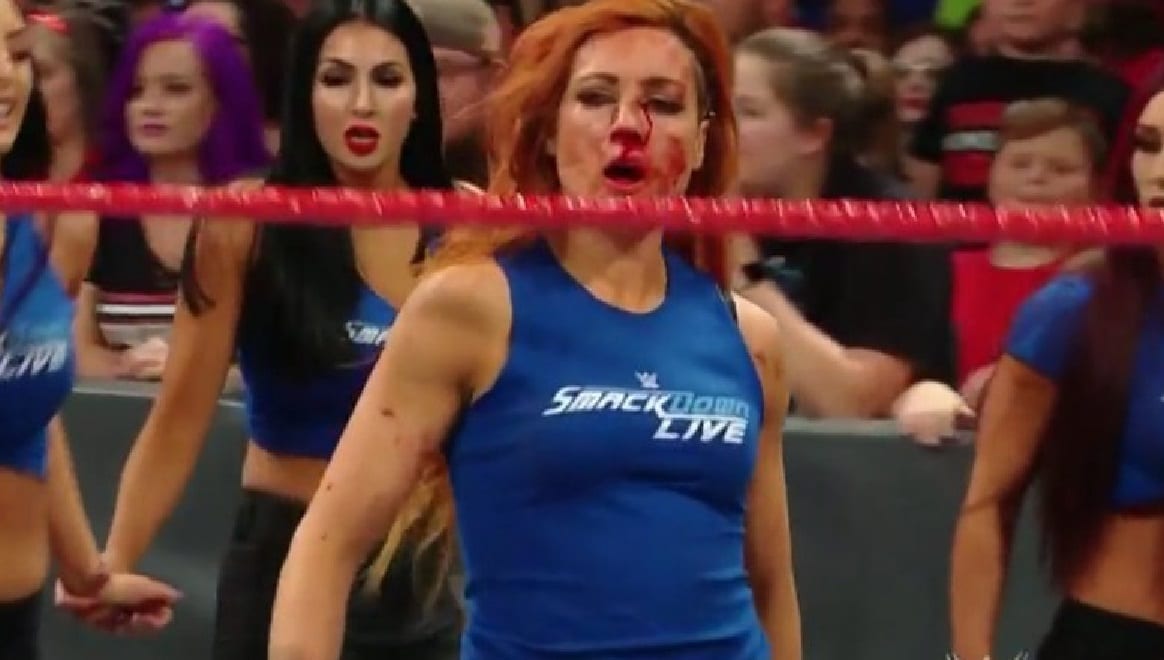 Becky Lynch Is Very Proud Of Her Bloody Appearance On WWE Raw