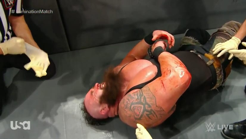 Braun Strowman Left Bloody & Injured After Attack On WWE Raw