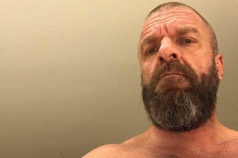 Triple H Shows Off Brutal Bruises Before Surgery