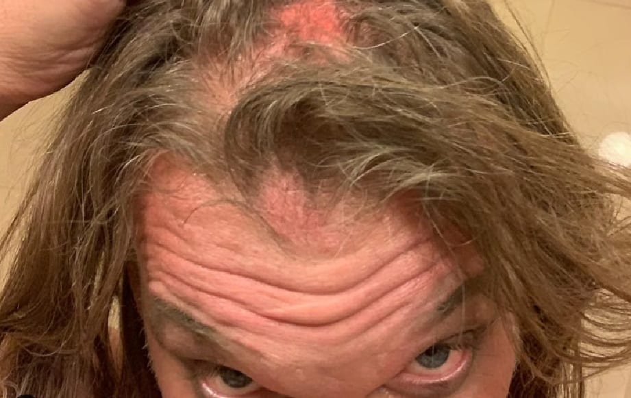 Chris Jericho Was Scalped During Wrestle Kingdom Match