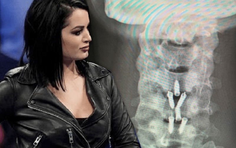 Paige Shows Off Surgically Repaired Neck