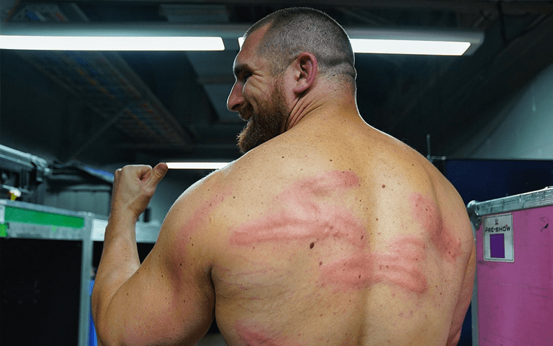 Mojo Rawley Shows Off Destroyed Back After Kevin Owens Attack On WWE RAW