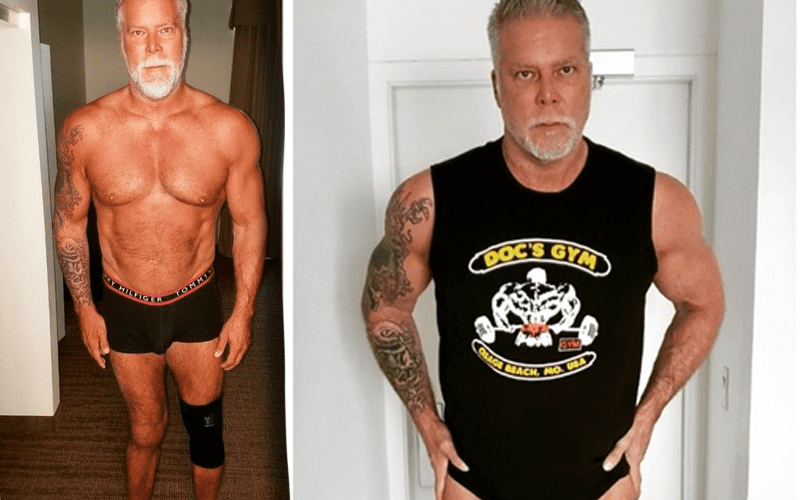 Kevin Nash Reveals Before & After Photos Of His ‘Crippled & Deformed’ Knees