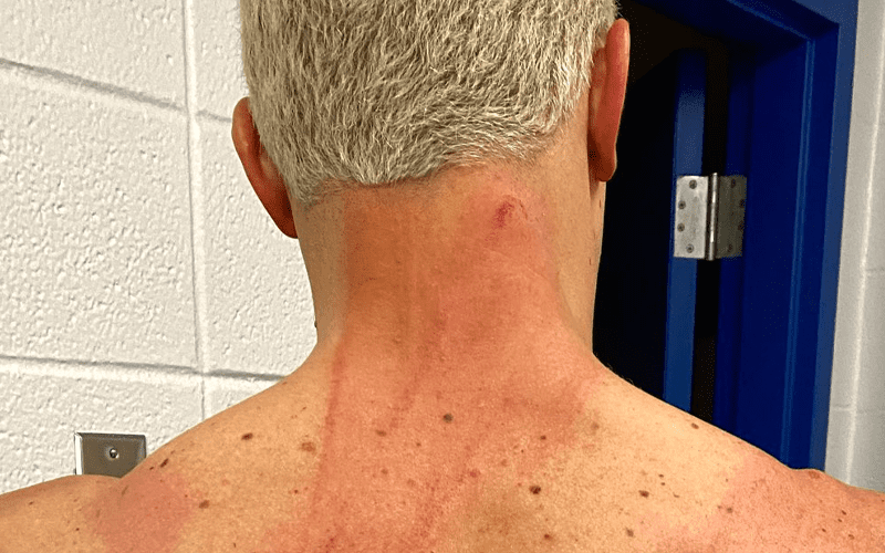 Cody Rhodes Shows Off Welted Back After Taking 10 Lashes On AEW Dynamite